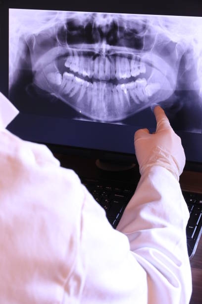 Best Cracked Tooth Emergency Dentist  in Hazlehurst, MS