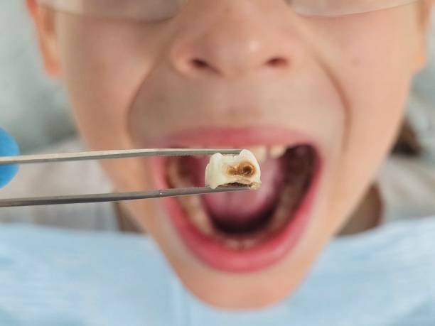Best Dentist for Dental Trauma  in Hazlehurst, MS